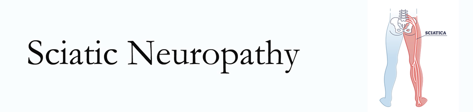 Murfreesboro neuropathy pain (sciatica) 